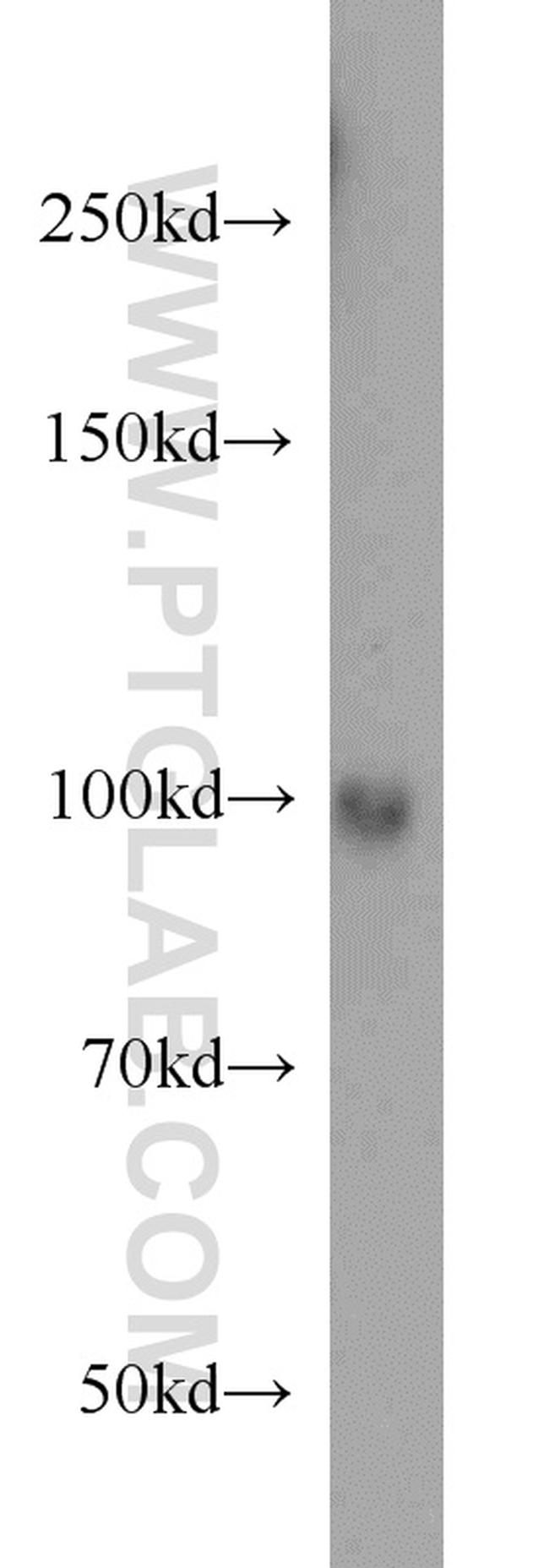 LONP1 Antibody in Western Blot (WB)