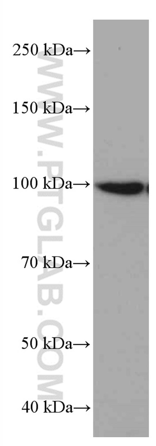 LONP1 Antibody in Western Blot (WB)