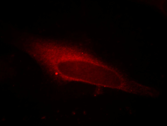 LPCAT1 Antibody in Immunocytochemistry (ICC/IF)