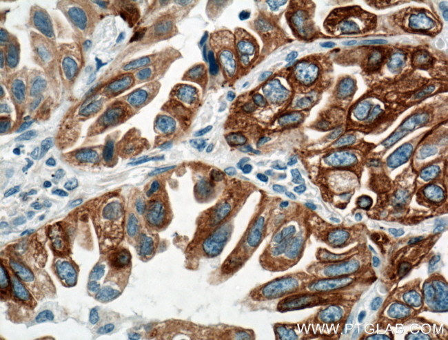 LPCAT1 Antibody in Immunohistochemistry (Paraffin) (IHC (P))