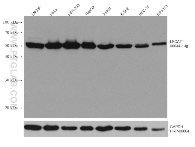 LPCAT1 Antibody in Western Blot (WB)