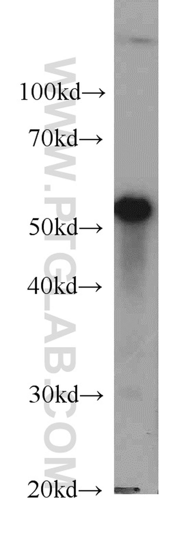 LPCAT1 Antibody in Western Blot (WB)