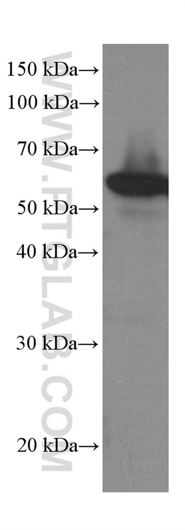 LPCAT1 Antibody in Western Blot (WB)