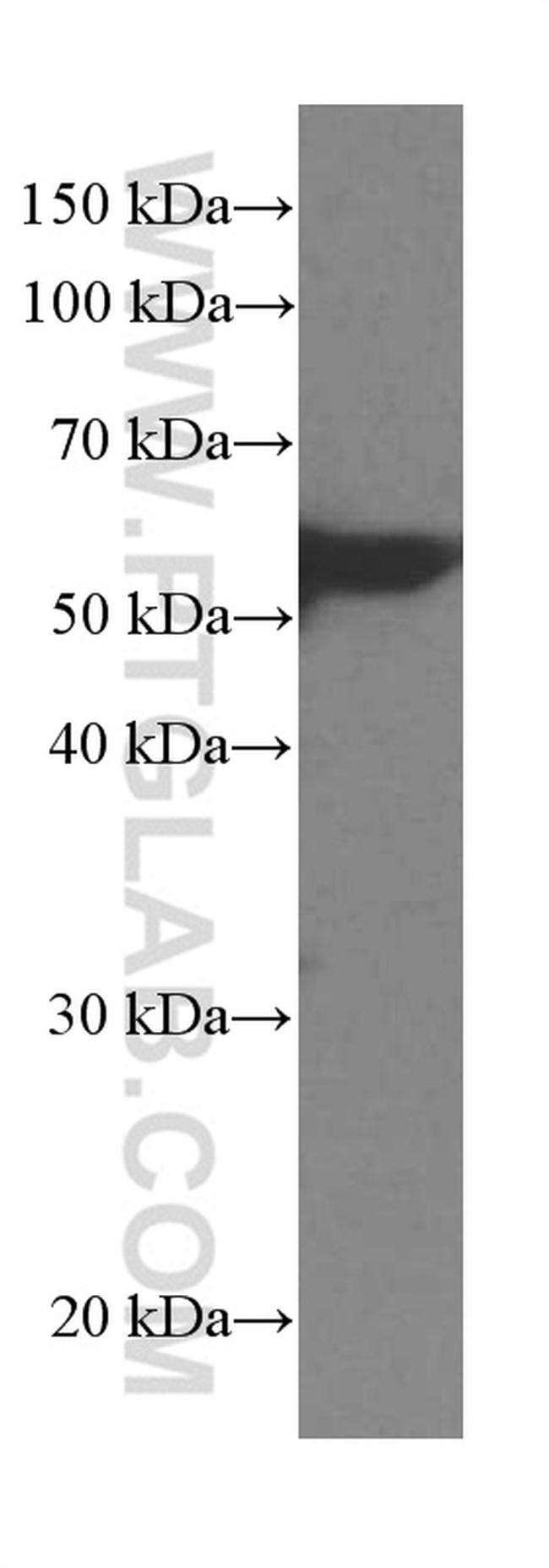 LPCAT1 Antibody in Western Blot (WB)