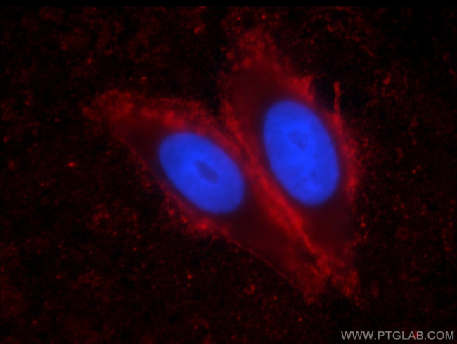 IA-2/PTPRN Antibody in Immunocytochemistry (ICC/IF)