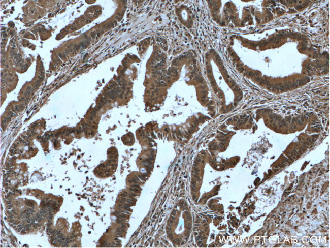 IA-2/PTPRN Antibody in Immunohistochemistry (Paraffin) (IHC (P))