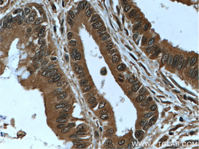 IA-2/PTPRN Antibody in Immunohistochemistry (Paraffin) (IHC (P))