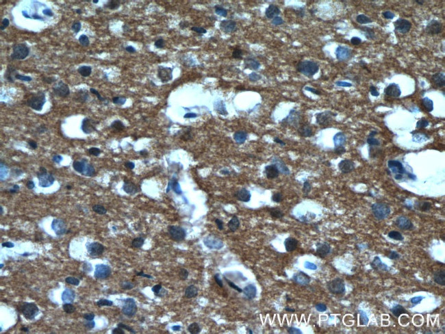 IA-2/PTPRN Antibody in Immunohistochemistry (Paraffin) (IHC (P))