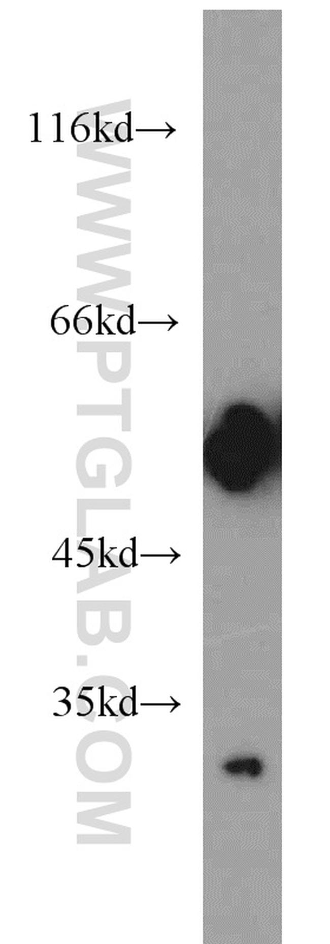 IA-2/PTPRN Antibody in Western Blot (WB)