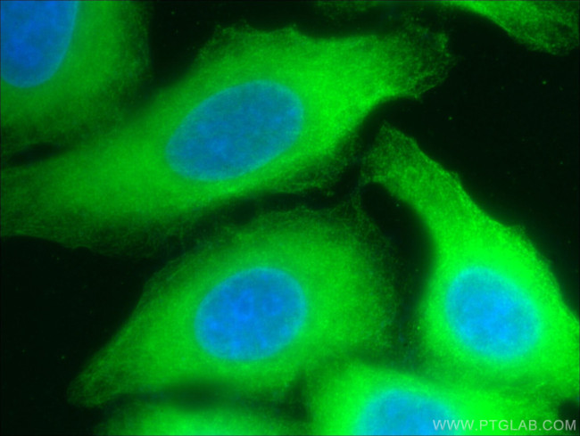 RPS3 Antibody in Immunocytochemistry (ICC/IF)