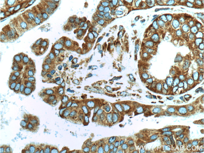 RPS3 Antibody in Immunohistochemistry (Paraffin) (IHC (P))