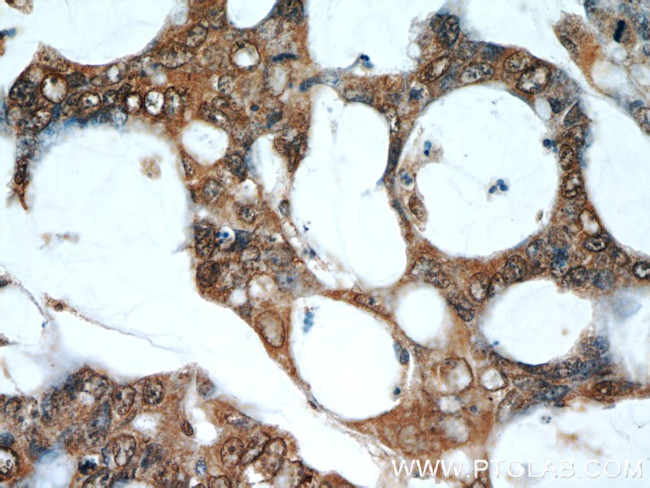 RPS3 Antibody in Immunohistochemistry (Paraffin) (IHC (P))