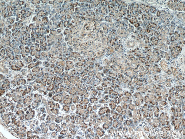 RPS3 Antibody in Immunohistochemistry (Paraffin) (IHC (P))