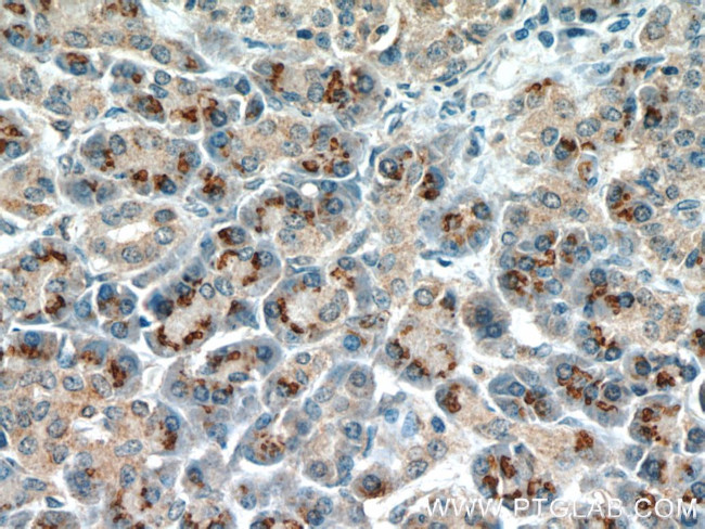 RPS3 Antibody in Immunohistochemistry (Paraffin) (IHC (P))