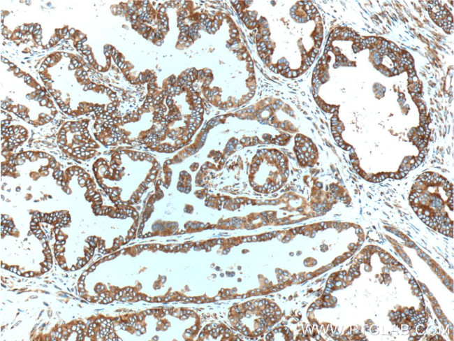 RPS3 Antibody in Immunohistochemistry (Paraffin) (IHC (P))