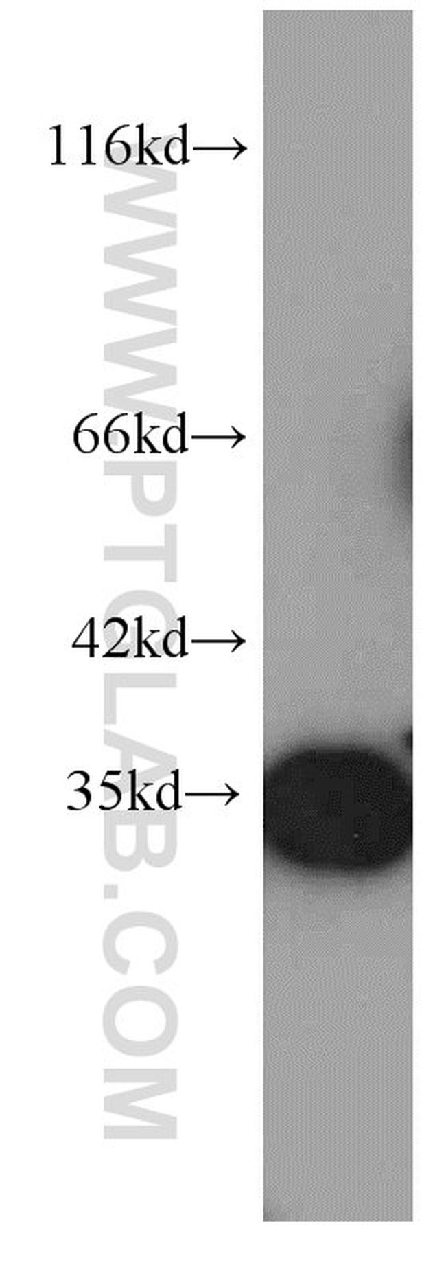 RPS3 Antibody in Western Blot (WB)