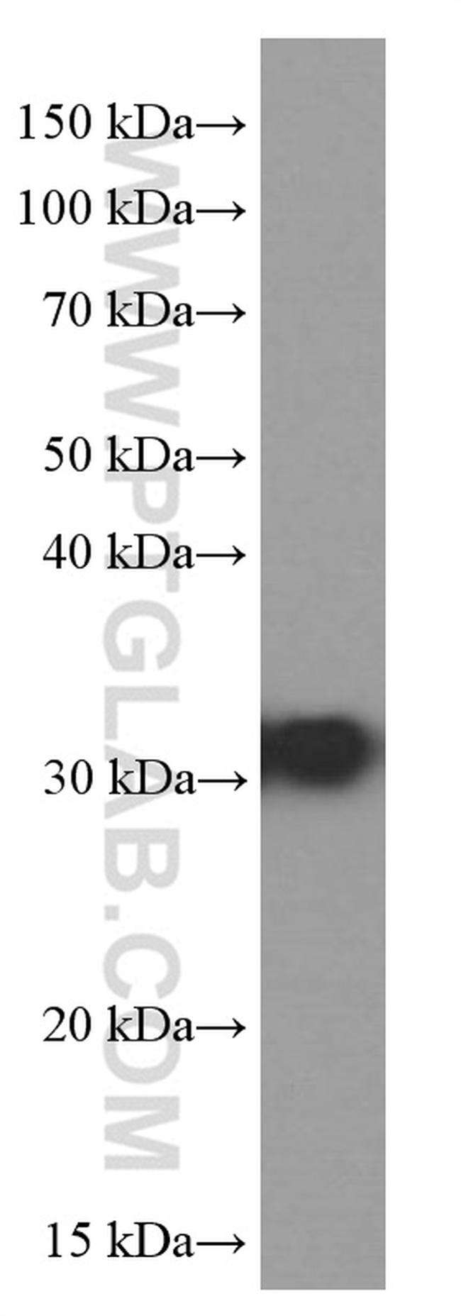 RPS3 Antibody in Western Blot (WB)