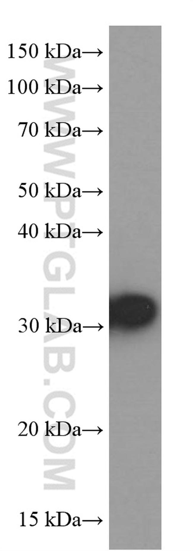 RPS3 Antibody in Western Blot (WB)