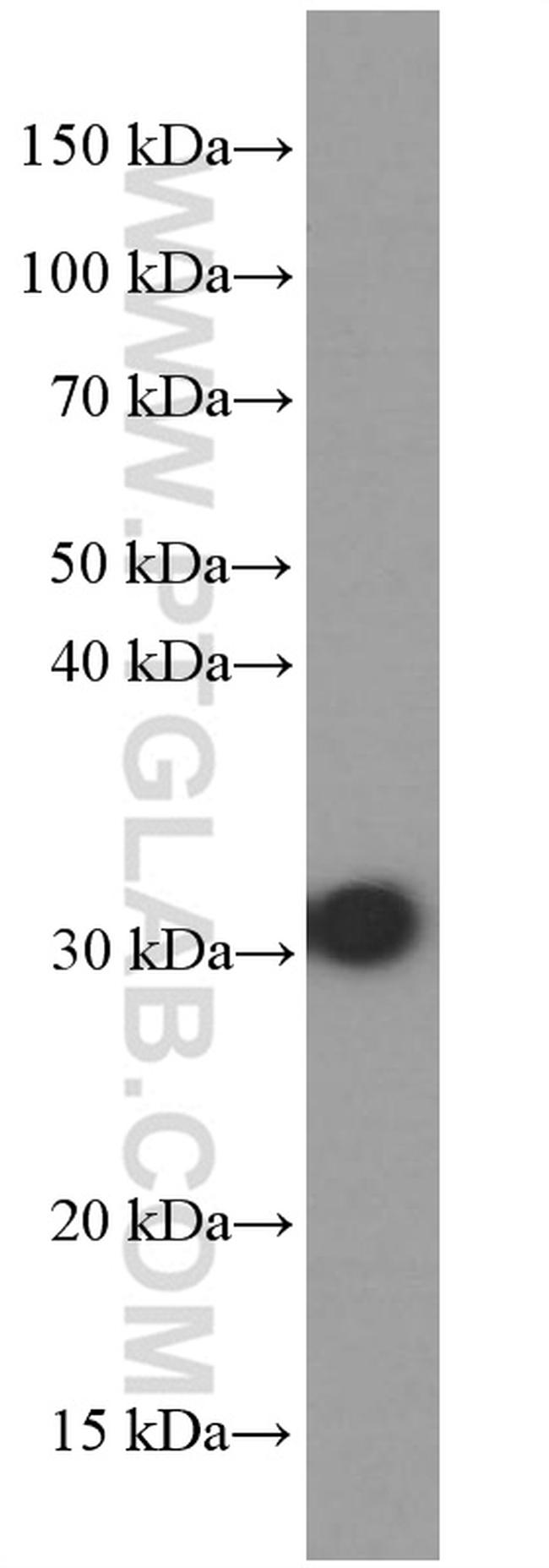 RPS3 Antibody in Western Blot (WB)