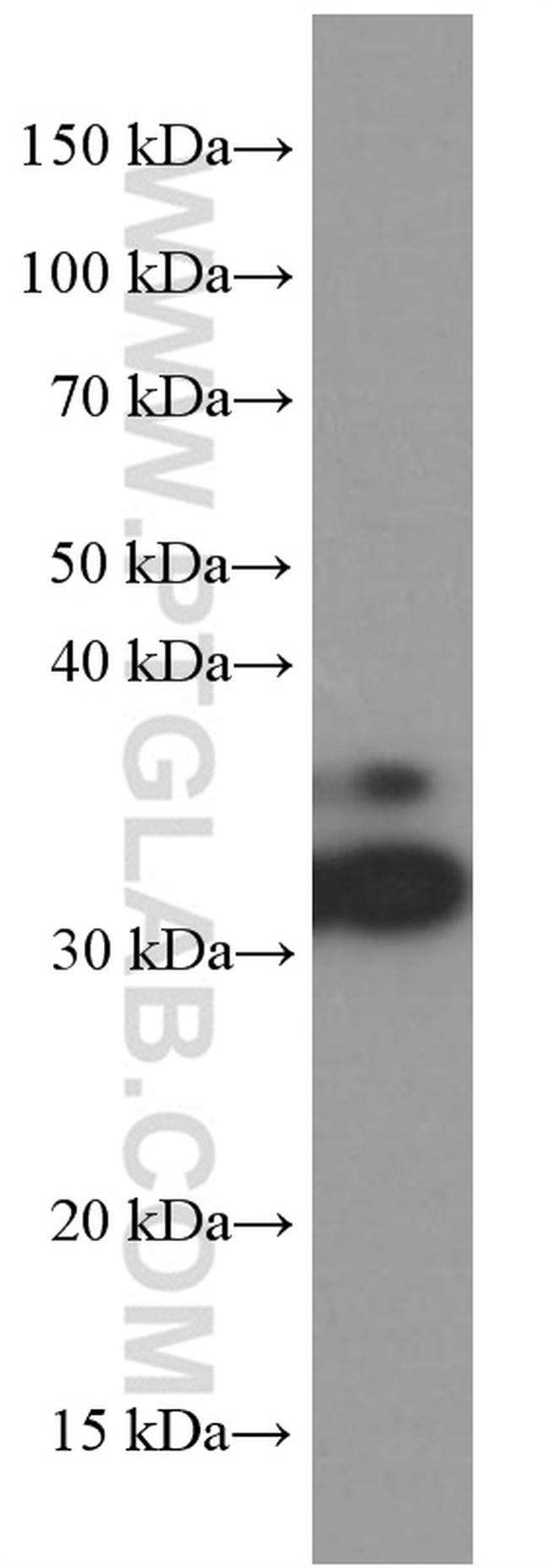 RPS3 Antibody in Western Blot (WB)