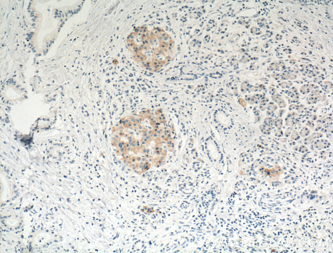 Cyclophilin B Antibody in Immunohistochemistry (Paraffin) (IHC (P))