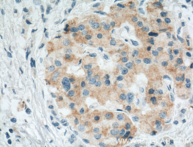 Cyclophilin B Antibody in Immunohistochemistry (Paraffin) (IHC (P))