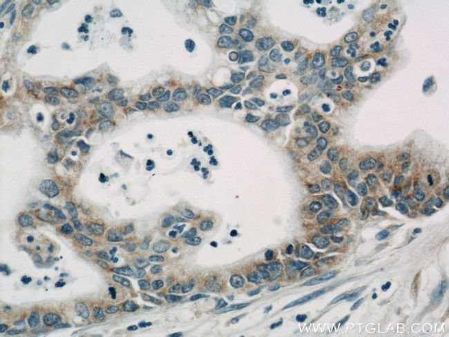 Cyclophilin B Antibody in Immunohistochemistry (Paraffin) (IHC (P))