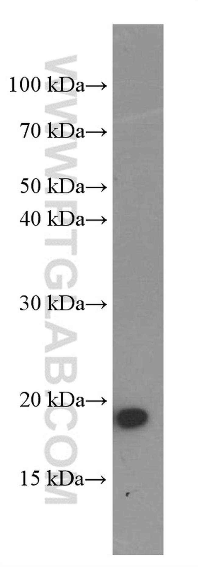 Cyclophilin B Antibody in Western Blot (WB)