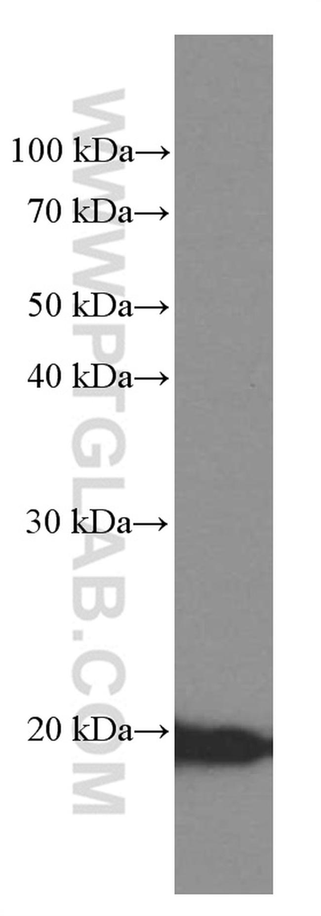 Cyclophilin B Antibody in Western Blot (WB)