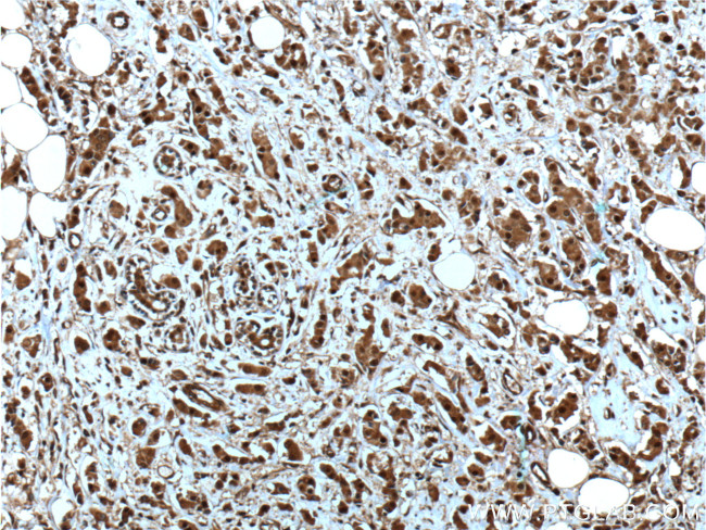 NOB1 Antibody in Immunohistochemistry (Paraffin) (IHC (P))
