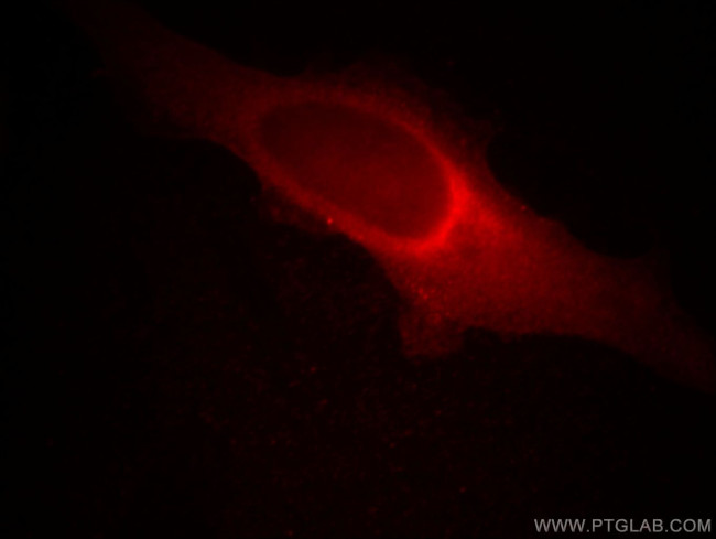 MMS19 Antibody in Immunocytochemistry (ICC/IF)