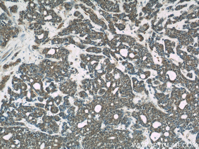 MMS19 Antibody in Immunohistochemistry (Paraffin) (IHC (P))