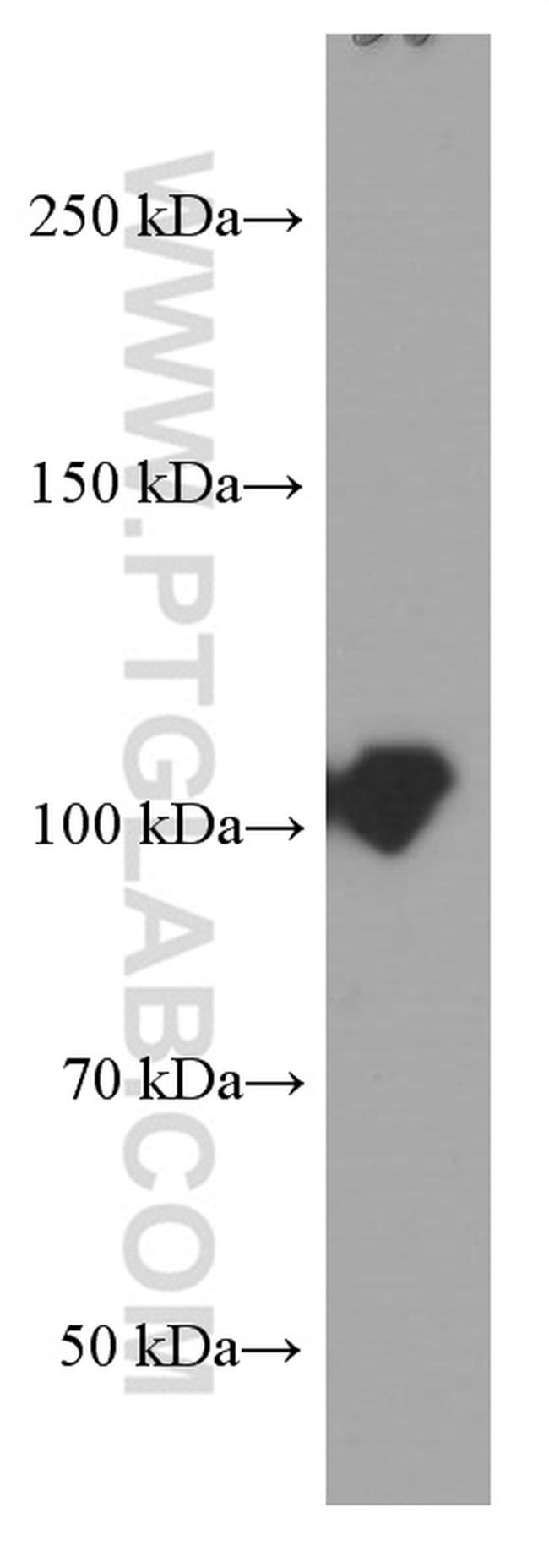 MMS19 Antibody in Western Blot (WB)