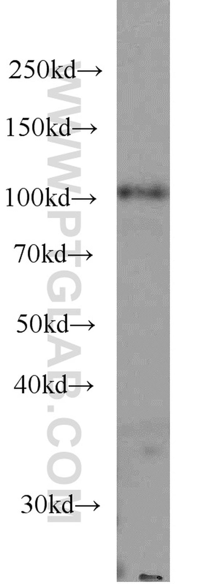 MMS19 Antibody in Western Blot (WB)