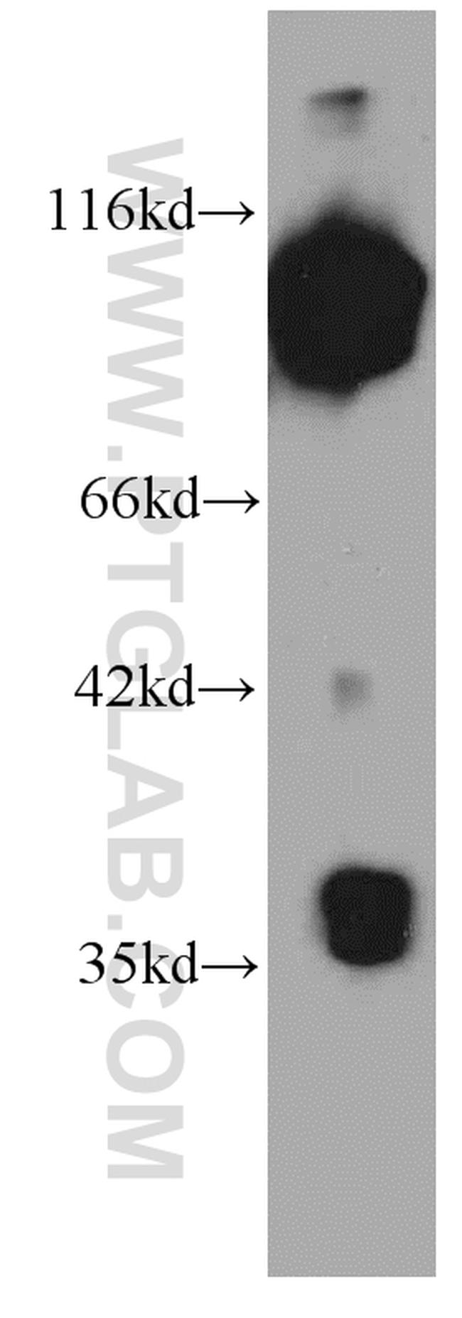 MMS19 Antibody in Western Blot (WB)