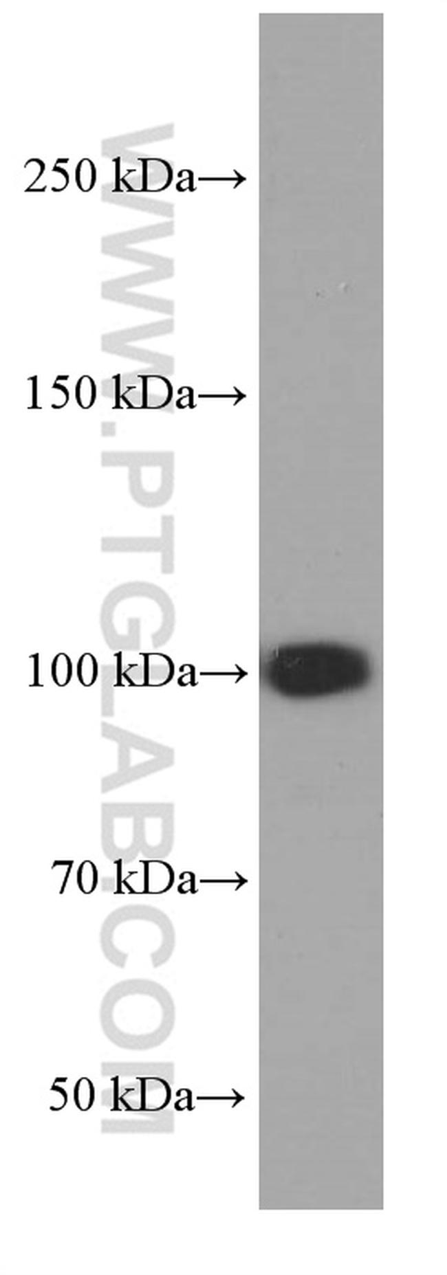 MMS19 Antibody in Western Blot (WB)