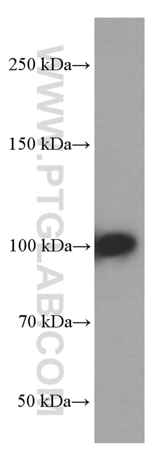 MMS19 Antibody in Western Blot (WB)