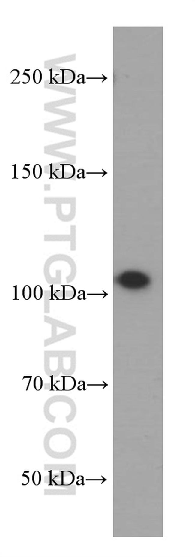 MMS19 Antibody in Western Blot (WB)