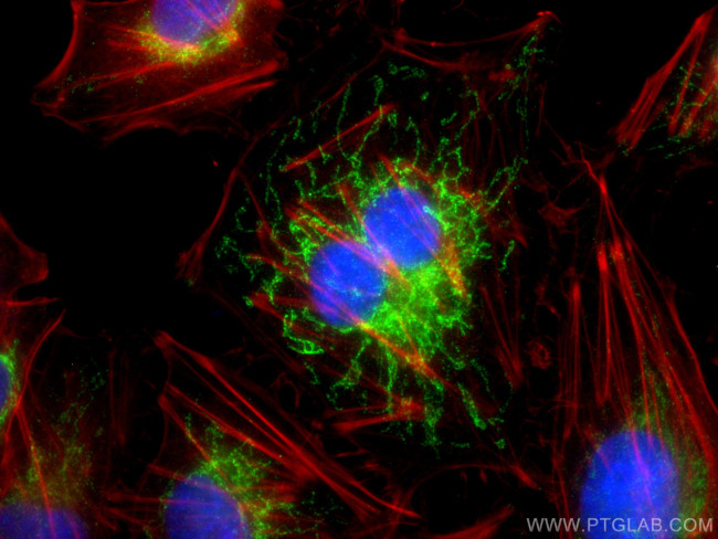 NDUFA4L2 Antibody in Immunocytochemistry (ICC/IF)