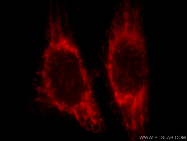 NDUFA4L2 Antibody in Immunocytochemistry (ICC/IF)