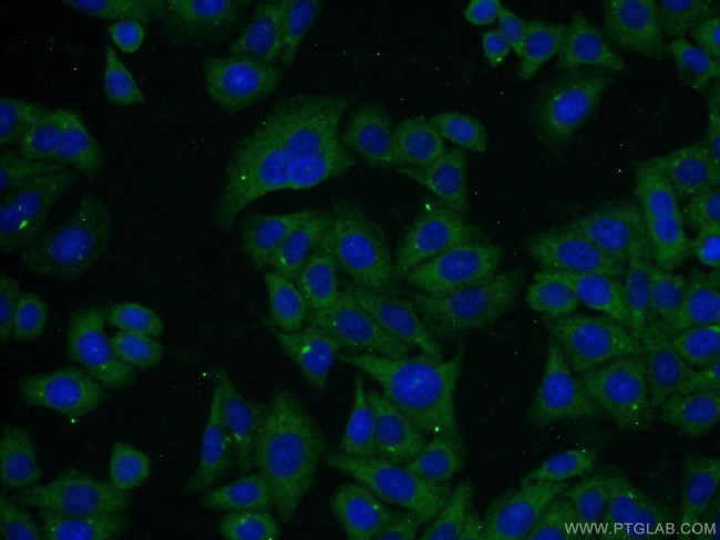 Albumin Antibody in Immunocytochemistry (ICC/IF)