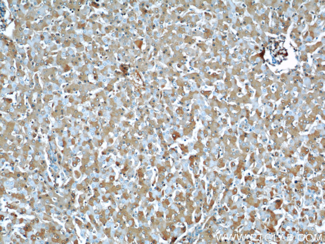 Albumin Antibody in Immunohistochemistry (Paraffin) (IHC (P))