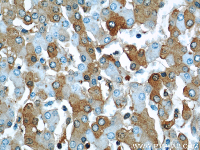 Albumin Antibody in Immunohistochemistry (Paraffin) (IHC (P))