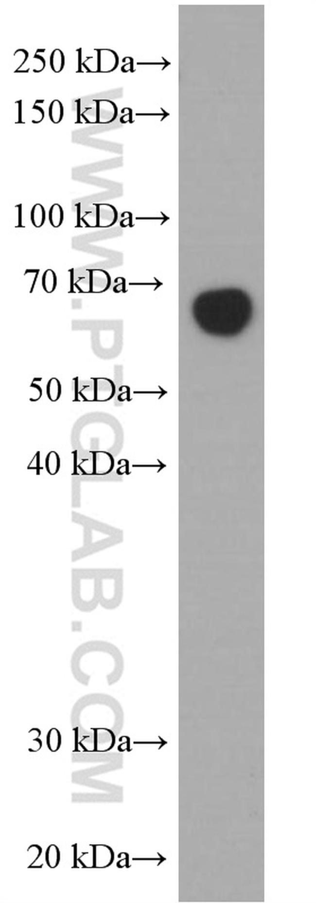 Albumin Antibody in Western Blot (WB)