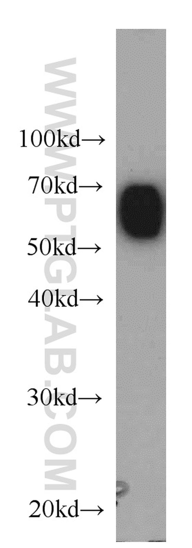 Albumin Antibody in Western Blot (WB)