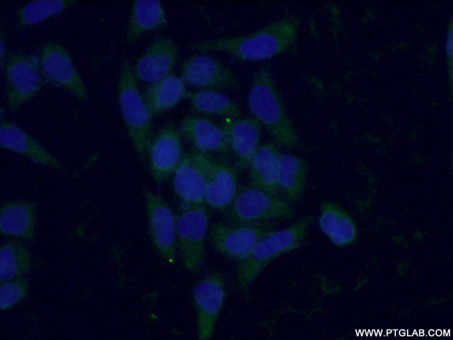 Antithrombin III Antibody in Immunocytochemistry (ICC/IF)