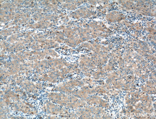 Antithrombin III Antibody in Immunohistochemistry (Paraffin) (IHC (P))