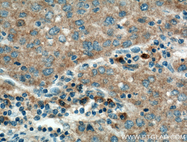 Antithrombin III Antibody in Immunohistochemistry (Paraffin) (IHC (P))