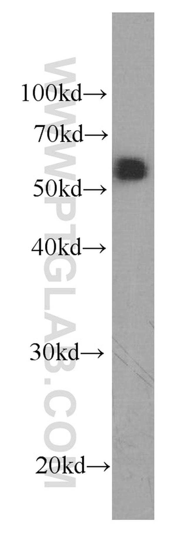 Antithrombin III Antibody in Western Blot (WB)