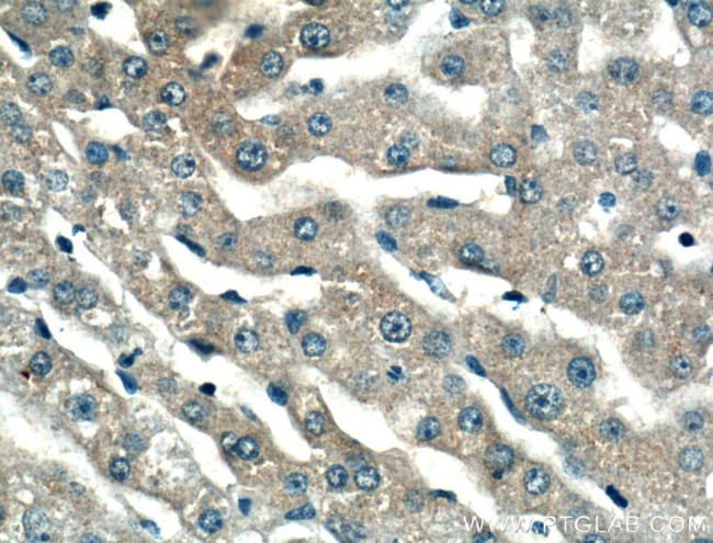 Antithrombin III Antibody in Immunohistochemistry (Paraffin) (IHC (P))